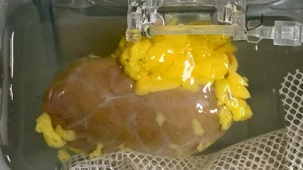 Учёные преобразовали почку группы A в универсальную, что может ускорить трансплантации