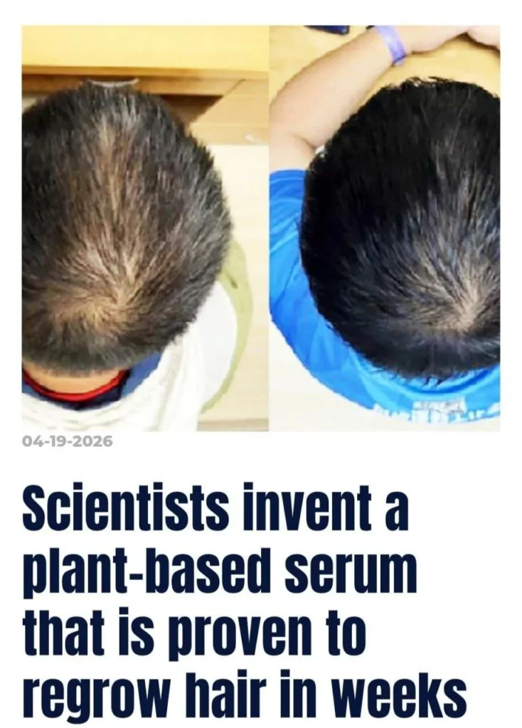 Китайские учёные разработали сыворотку для стимуляции роста волос